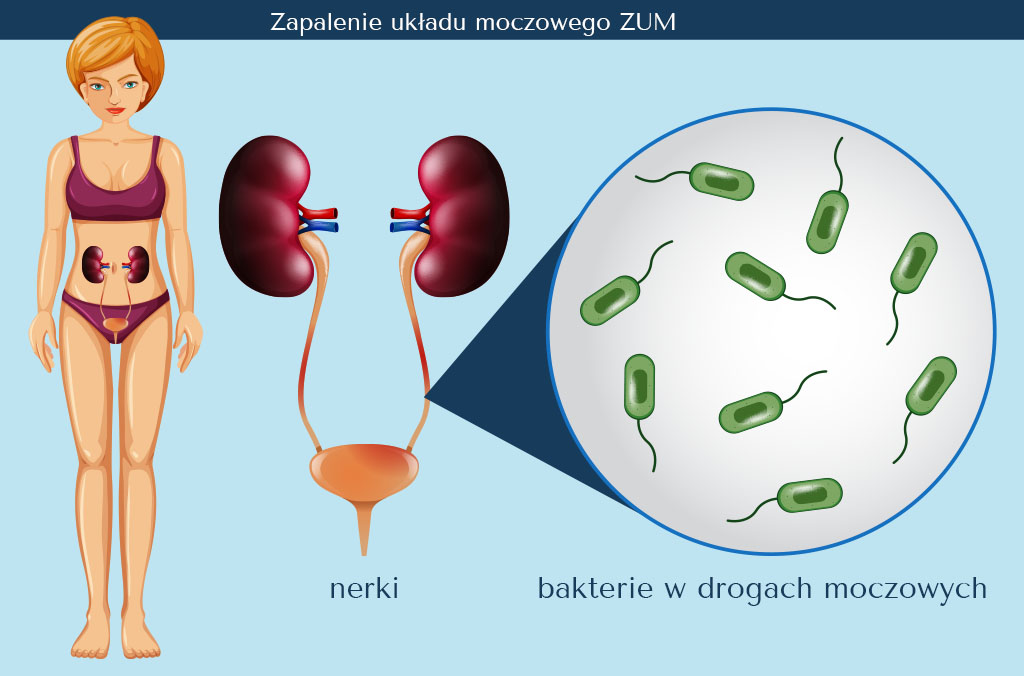 receptury babuszki agafii szampon na zmrożonej wodzie przeciw wypadaniu